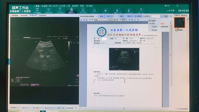 目前，市场上的肿瘤筛查体检套餐主要分为以下几类：